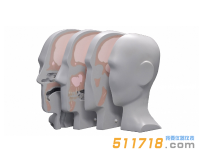 美國CIRS 731-HN頭部模體