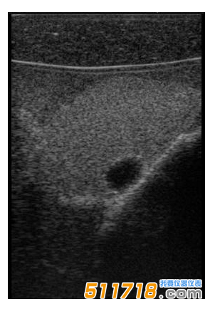 1534992907438311.png 美國CIRS 074甲狀腺超聲訓(xùn)練模體1.png